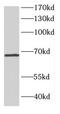 Catenin Beta Like 1 antibody, FNab02058, FineTest, Western Blot image 