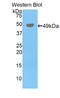 Peroxiredoxin 3 antibody, LS-C304530, Lifespan Biosciences, Western Blot image 
