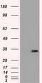 CD32a antibody, LS-C784419, Lifespan Biosciences, Western Blot image 