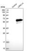 Leucine Rich Repeat Containing 14 antibody, PA5-54316, Invitrogen Antibodies, Western Blot image 