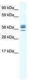 Homeobox protein ESX1 antibody, TA341760, Origene, Western Blot image 