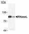 Ribonuclease L antibody, MA1-16575, Invitrogen Antibodies, Western Blot image 