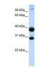 Zinc Finger Protein 138 antibody, NBP1-79236, Novus Biologicals, Western Blot image 