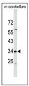 Solute Carrier Family 39 Member 3 antibody, AP53782PU-N, Origene, Western Blot image 