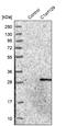 Chromosome 1 Open Reading Frame 109 antibody, NBP1-82175, Novus Biologicals, Western Blot image 