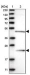 Guanine Deaminase antibody, PA5-54976, Invitrogen Antibodies, Western Blot image 
