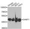 Serine hydroxymethyltransferase, cytosolic antibody, STJ110038, St John