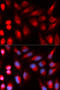 DNA Cross-Link Repair 1C antibody, 19-757, ProSci, Immunofluorescence image 