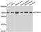 Myotubularin Related Protein 14 antibody, orb248011, Biorbyt, Western Blot image 