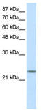 MAX Dimerization Protein 3 antibody, TA329109, Origene, Western Blot image 