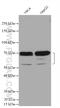 Zinc finger and BTB domain-containing protein 7B antibody, 28127-1-AP, Proteintech Group, Western Blot image 