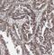 CCCTC-Binding Factor Like antibody, FNab00931, FineTest, Immunohistochemistry frozen image 