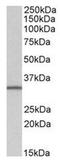 SLC9A3 Regulator 2 antibody, AP31560PU-N, Origene, Western Blot image 