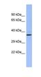 CHRNA7 (Exons 5-10) And FAM7A (Exons A-E) Fusion antibody, orb329875, Biorbyt, Western Blot image 