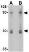 Solute Carrier Family 9 Member A1 antibody, GTX85046, GeneTex, Western Blot image 