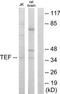 TEF Transcription Factor, PAR BZIP Family Member antibody, TA314609, Origene, Western Blot image 