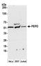 Peptidase D antibody, A305-311A, Bethyl Labs, Western Blot image 