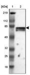 Coiled-coil domain-containing protein 22 antibody, NBP1-84331, Novus Biologicals, Western Blot image 