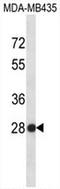 Small Nuclear Ribonucleoprotein Polypeptide B2 antibody, AP53965PU-N, Origene, Western Blot image 