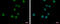 VPS37C Subunit Of ESCRT-I antibody, GTX108053, GeneTex, Immunocytochemistry image 