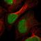 Signal Peptidase Complex Subunit 2 antibody, HPA013386, Atlas Antibodies, Immunocytochemistry image 