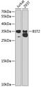 CD317 antibody, 18-381, ProSci, Western Blot image 