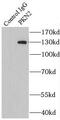 Serine/threonine-protein kinase N2 antibody, FNab06498, FineTest, Immunoprecipitation image 