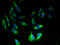 AP2S1 antibody, A51809-100, Epigentek, Immunofluorescence image 