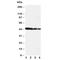 Delta Like Canonical Notch Ligand 3 antibody, R31012, NSJ Bioreagents, Western Blot image 