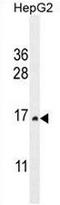 Cystatin 9 antibody, AP51107PU-N, Origene, Western Blot image 