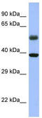 RNA Binding Fox-1 Homolog 1 antibody, TA344419, Origene, Western Blot image 