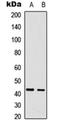 Cell division cycle-associated protein 7 antibody, orb235081, Biorbyt, Western Blot image 