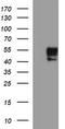 Matrix Metallopeptidase 13 antibody, TA506688AM, Origene, Western Blot image 