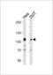 EPH Receptor A10 antibody, GTX81357, GeneTex, Western Blot image 