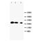 Stromelysin-2 antibody, orb27592, Biorbyt, Western Blot image 