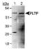 Phospholipid Transfer Protein antibody, PA3-16790, Invitrogen Antibodies, Western Blot image 