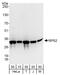 Ribosomal Protein S2 antibody, A303-794A, Bethyl Labs, Western Blot image 