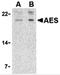 Amino-terminal enhancer of split antibody, 3609, ProSci Inc, Western Blot image 