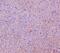 Keratin 18 antibody, M01357-2, Boster Biological Technology, Immunohistochemistry paraffin image 