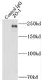 Tight Junction Protein 1 antibody, FNab09751, FineTest, Immunoprecipitation image 