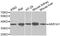 Aldo-Keto Reductase Family 1 Member A1 antibody, A1068, ABclonal Technology, Western Blot image 