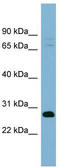 Transmembrane Protein 176A antibody, TA331856, Origene, Western Blot image 