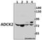AarF Domain Containing Kinase 2 antibody, A15887Y256, Boster Biological Technology, Western Blot image 