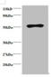 Immunoglobulin Heavy Constant Gamma 1 (G1m Marker) antibody, A57584-100, Epigentek, Western Blot image 