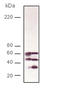 Calcineurin A antibody, ADI-SPA-610-F, Enzo Life Sciences, Western Blot image 