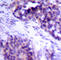BCL2 Like 1 antibody, AP0314, ABclonal Technology, Immunohistochemistry paraffin image 