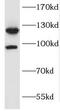 FGFR-2 antibody, FNab03102, FineTest, Western Blot image 