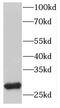 HLA class II histocompatibility antigen, DRB1-16 beta chain antibody, FNab03907, FineTest, Western Blot image 