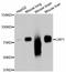 LDL Receptor Related Protein 1 antibody, abx125358, Abbexa, Western Blot image 