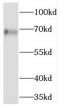 Carboxypeptidase Q antibody, FNab06352, FineTest, Western Blot image 